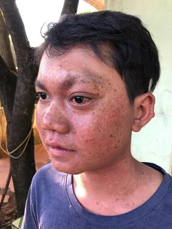 Xin cứu đôi mắt em! ảnh 1