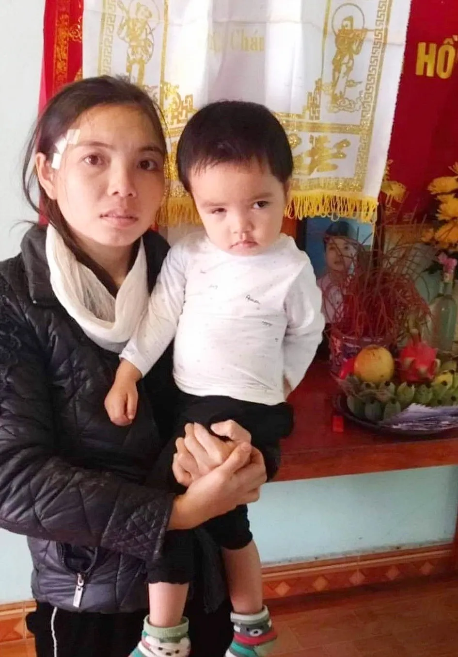 Bé gái 2 tuổi mong được cứu đôi mắt  ảnh 1