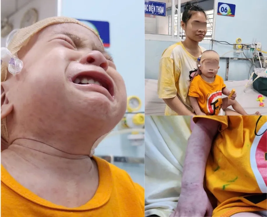 bn soi nhi dong 1.jpg