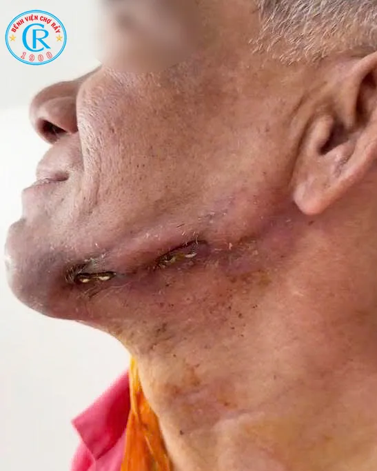 Hình ảnh trước mổ.jpg