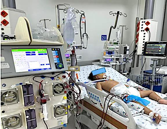Cứu-sống-một-trẻ-ngộ-độc-thuốc-paracetamol-nặng-nhờ-kỹ-thuật-thay-huyết-tương-1320x708.png