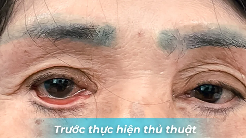 tham-my-bien-chưng-3.png