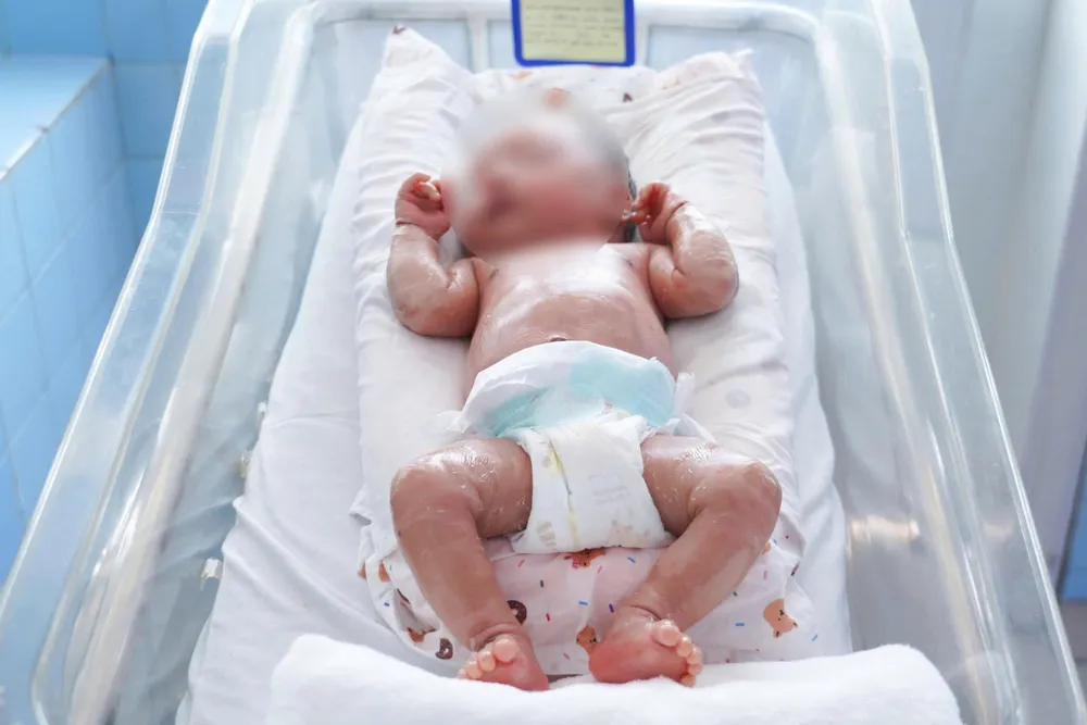 bệnh hiếm vảy cá