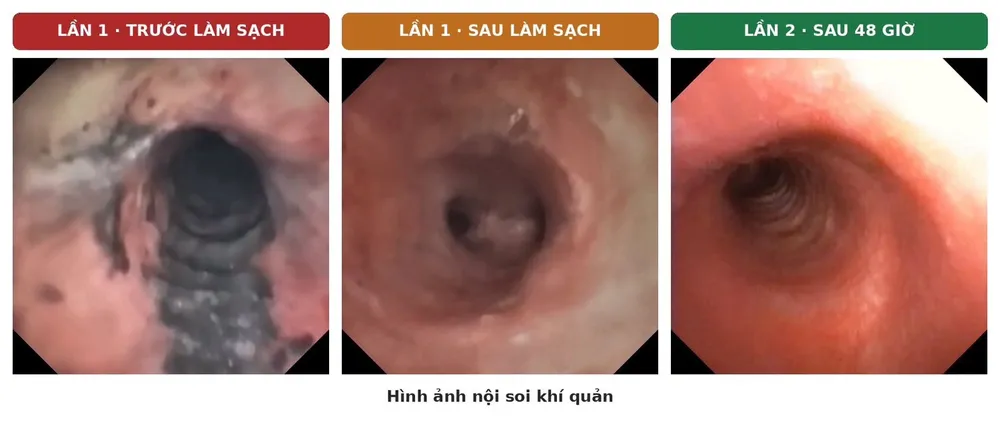 cháy sạc bỏng.jpg.png.jpeg