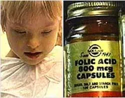 Cẩn trọng khi kê đơn viên sắt và vitamin B9 cho trẻ em