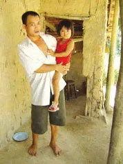 Hơn 200 em bị bệnh tim bẩm sinh cần phẫu thuật