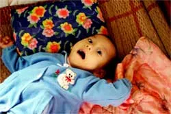 Phát hiện sự biến đổi gien ở những nạn nhân nhiễm chất độc hóa học