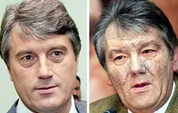 Ứng cử viên V.Yushchenko đã qua cơn nguy kịch
