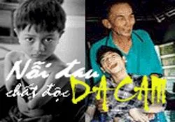 Đấu tranh vì quyền lợi chính đáng của nạn nhân chất độc da cam trên thế giới