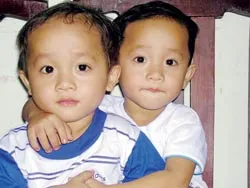 Hai anh em song sinh cùng bị ung thư máu