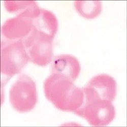 Hỏi – đáp về bệnh sốt rét