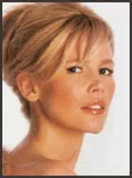 Người có tóc màu hoe bẩm sinh nhiều nguy cơ bị mắc chứng ung thư da