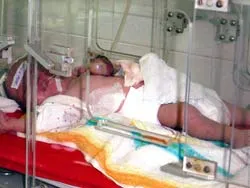 Cháu bé có tim ngoài lồng ngực đã được phẫu thuật