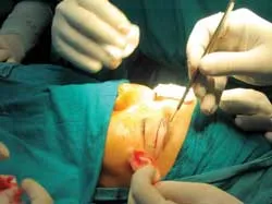 Làm đẹp “cửa sổ tâm hồn”