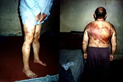 Gây phẫn nộ trong dư luận quốc tế