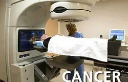 Kỹ thuật mới phát hiện sớm ung thư