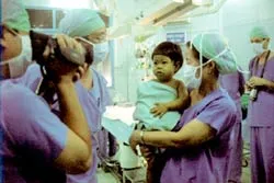 Khó khăn trong việc kết nối mạch máu