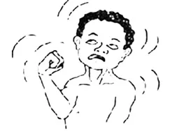 Bệnh động kinh tại Việt Nam