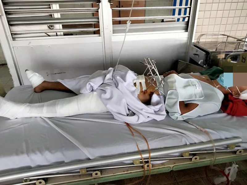 Truy bắt kẻ cướp, một công an xã bị tai nạn nguy kịch ảnh 2