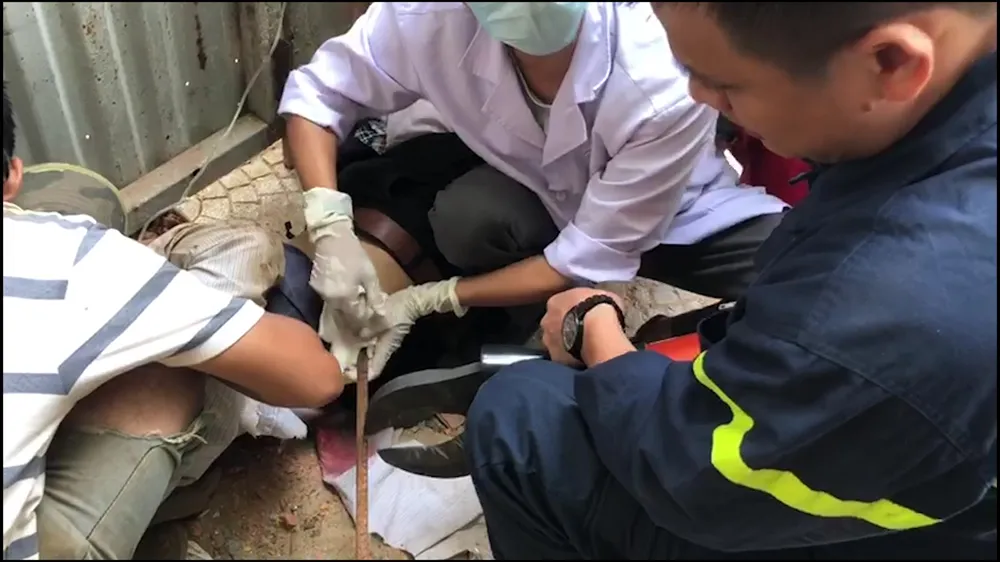 Một công nhân nguy kịch do thanh sắt dài 4m rơi trúng  ảnh 2