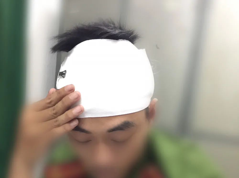 2 công an bị chém khi đang làm nhiệm vụ ảnh 1