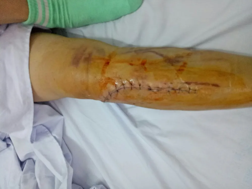 Điều tra vụ nguyên kế toán trưởng bị đánh gãy chân ở công ty  ảnh 1