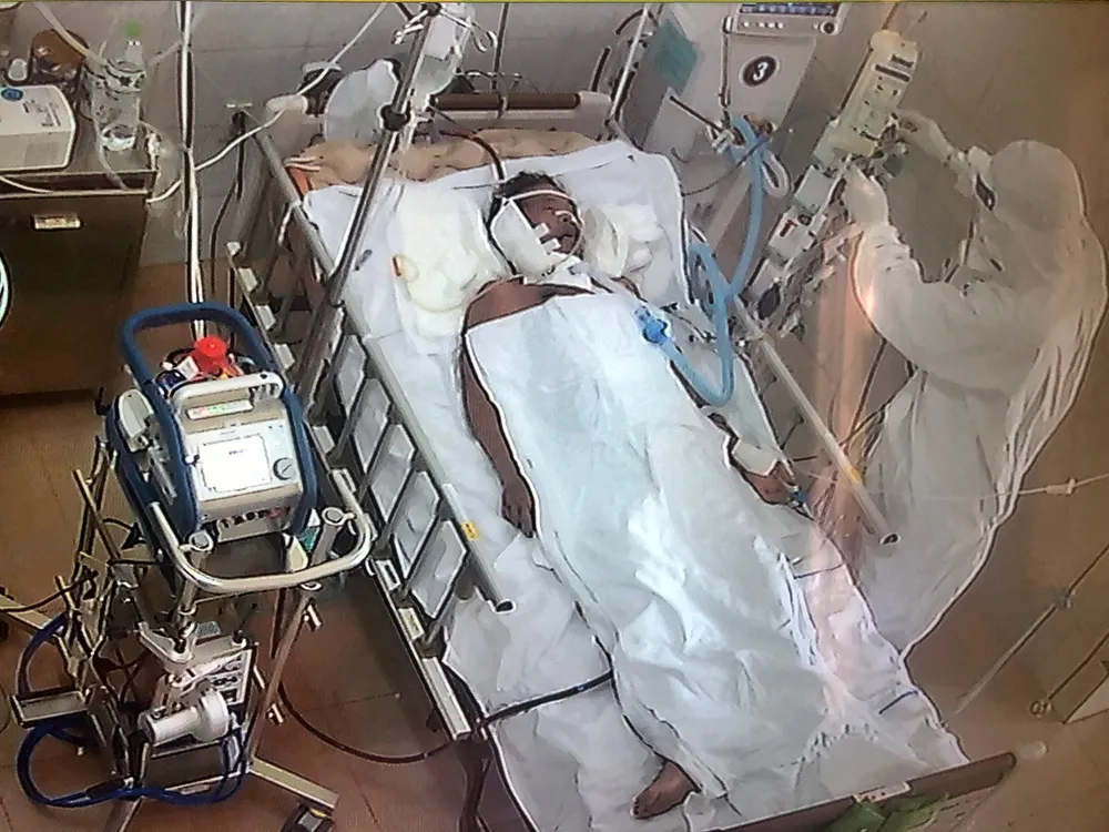 Bệnh nhân 416 đã khỏi Covid-19 nhưng tiên lượng còn rất nặng ảnh 1