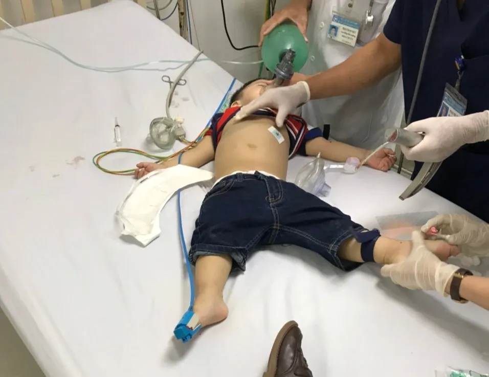Bé trai bị hóc thạch rau câu dẫn đến ngưng tim ảnh 1