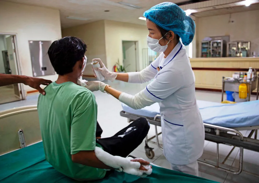 Một thiếu niên bị bỏng nặng do điện thoại phát nổ khi vừa dùng vừa sạc ảnh 1