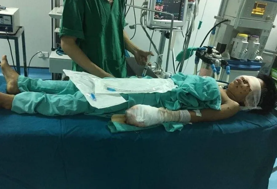 Một thiếu niên bị thương nặng sau tiếng nổ lớn ảnh 1