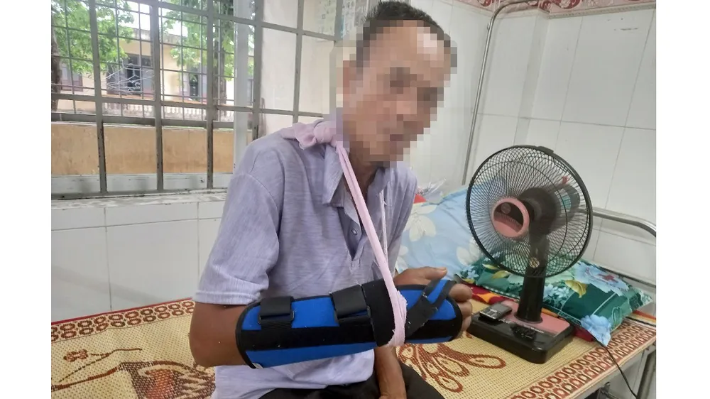 Ông T. bị khỉ vàng tấn công phải nhập viện