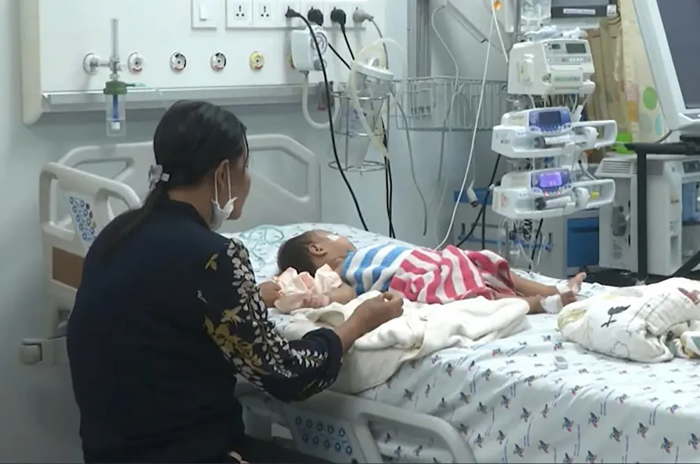 Bệnh nhi mắc tay chân miệng đang điều trị tại Bệnh viện Nhi Đồng Thành phố