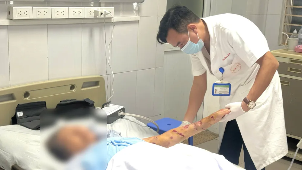 Vết thương do chó cắn có thể nhiễm trùng nếu không được xử trí đúng cách
