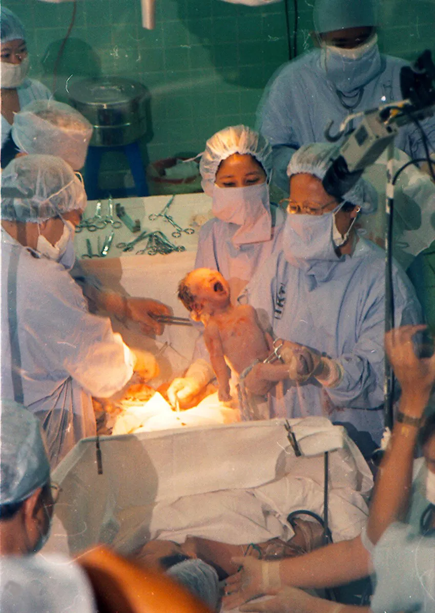 PSA thu tinh trong ong nghiem.jpg