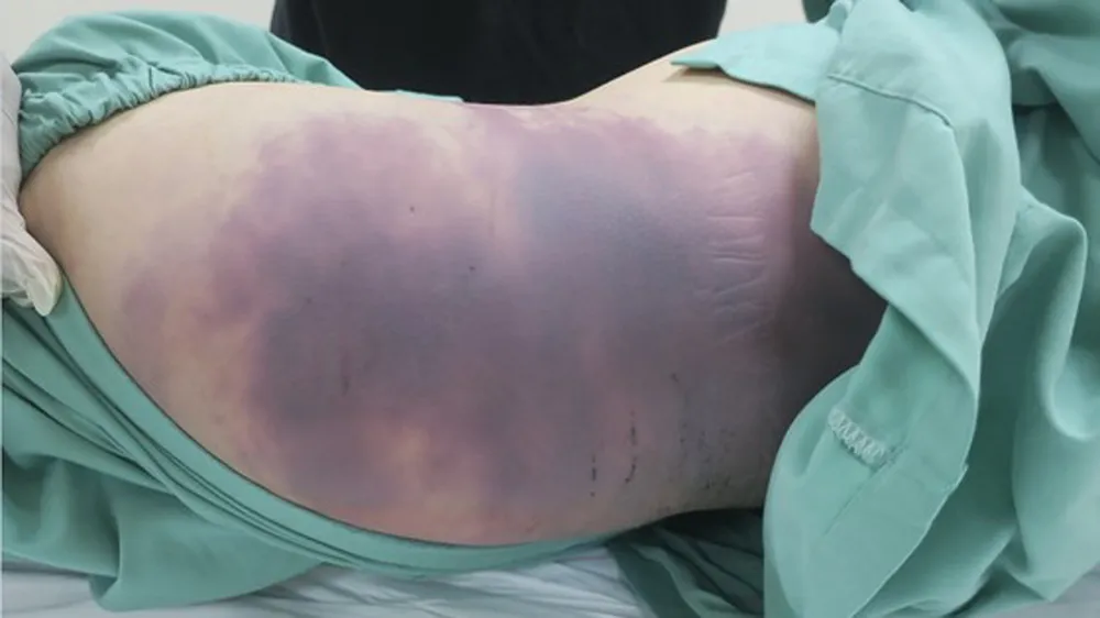 Ngày 21-7 xét xử công khai vụ án bạo hành bé gái 8 tuổi dẫn đến tử vong ở TPHCM ảnh 2