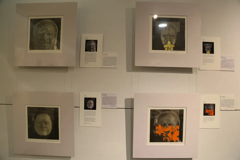 Hình ảnh MRI não của tác giả sau khi được chẩn đoán mắc bệnh Parkinsons. Ảnh: PHẠM NGA