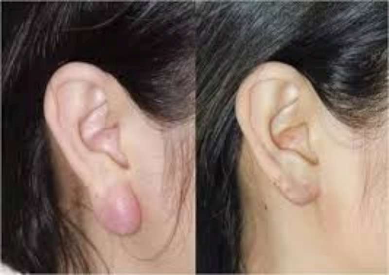 （示意圖源：互聯網）