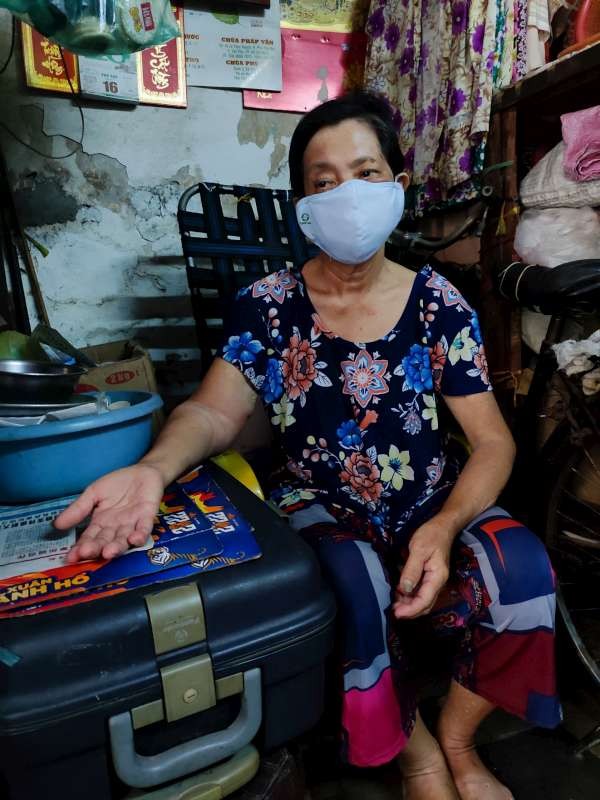 黎伍妹的右手浮腫又疼痛。