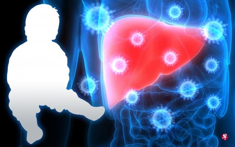 多國出現不明原因兒童急性肝炎