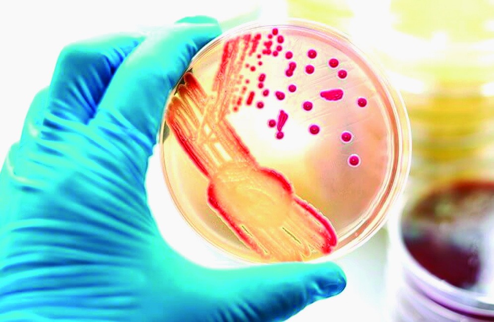 猴痘病患者的血液感染病毒致死亡危機。