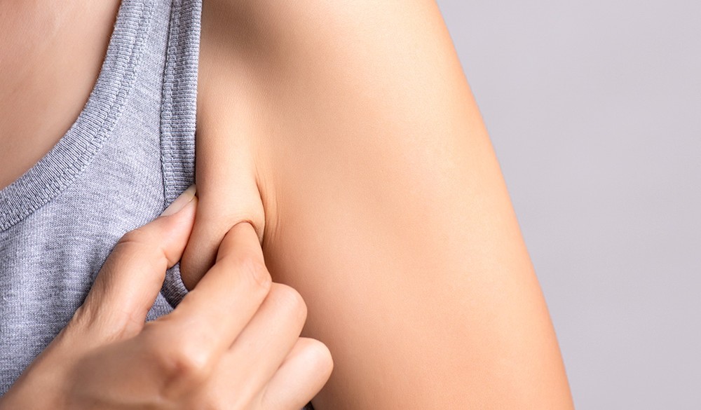 腋下“多肉”因為胖？