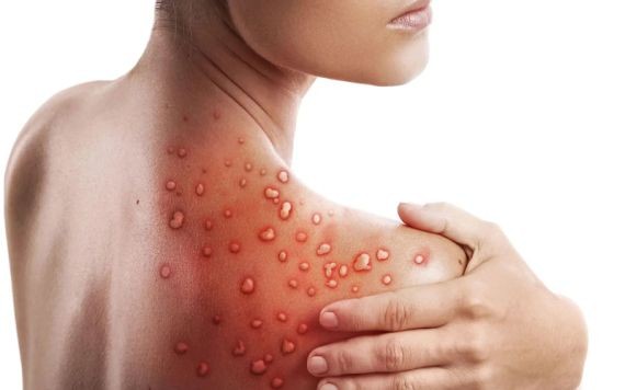 （示意圖：互聯網）