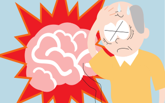 卒中後警惕抑鬱症