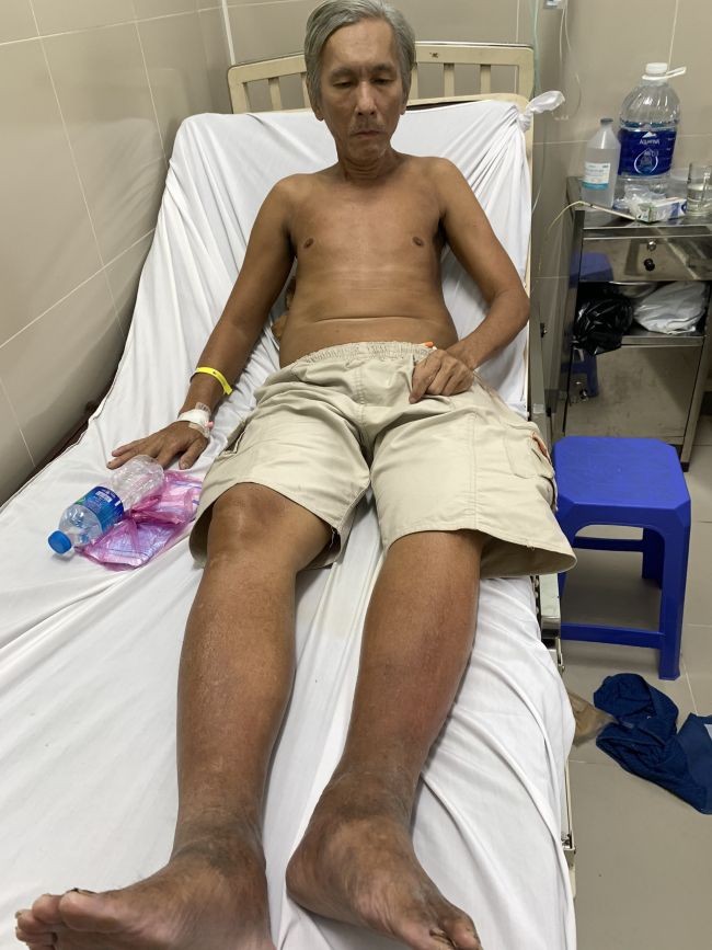 楊潤添正在醫院接受治療。