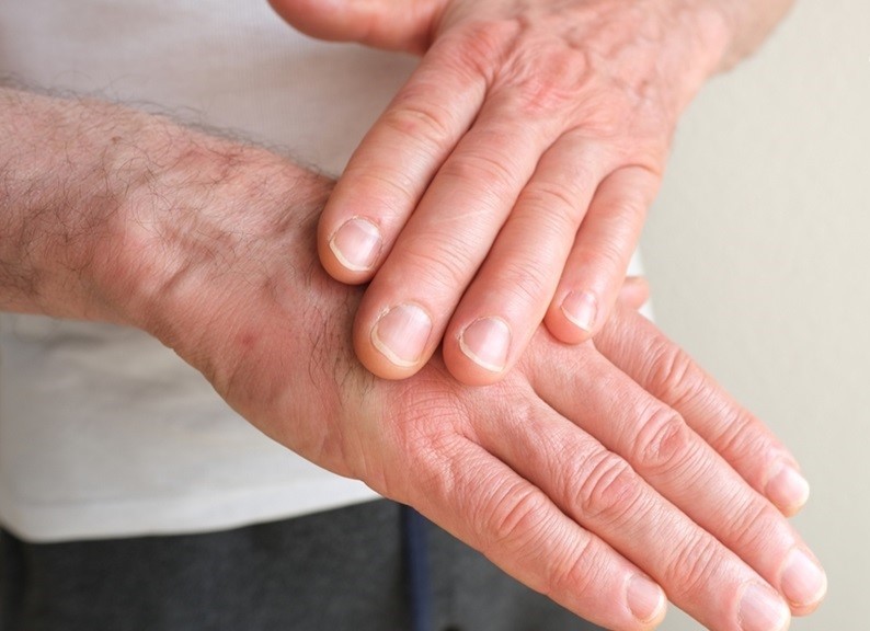 年纪愈大皮肤愈薄，皮肤薄小心病变危机！