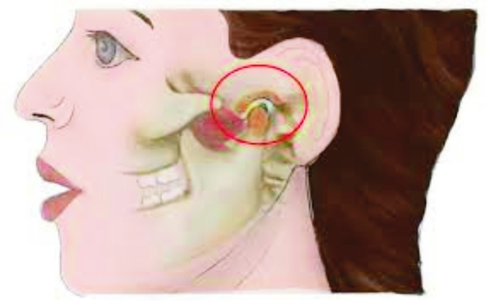 打哈欠、吃东西，嘴巴合不上或得了这种病