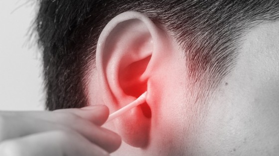 掏耳后“耳朵发臭流汤”听力受损30分贝