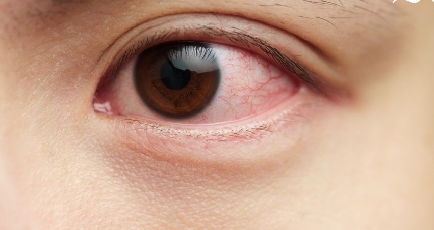 眼睛也会心肌梗塞！