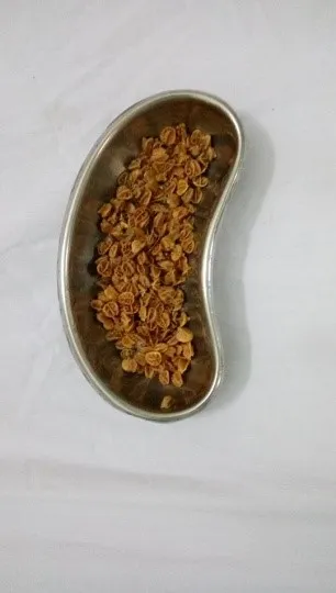 Bé trai 11 tuổi bị tắc hậu môn do nuốt hơn 70 gram hạt sơ ri ảnh 2