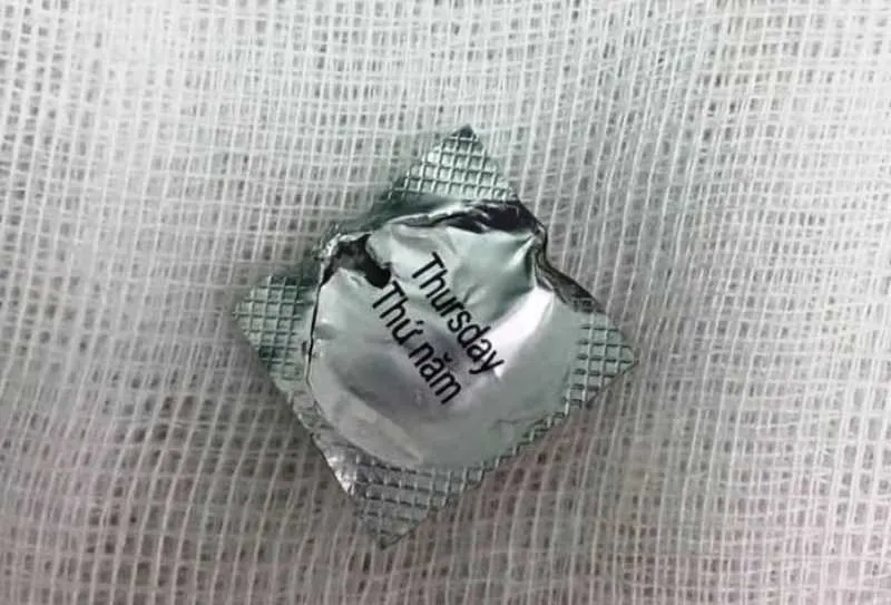 Bệnh nhân nuốt viên thuốc còn nguyên vỏ đâm vào thực quản ảnh 1